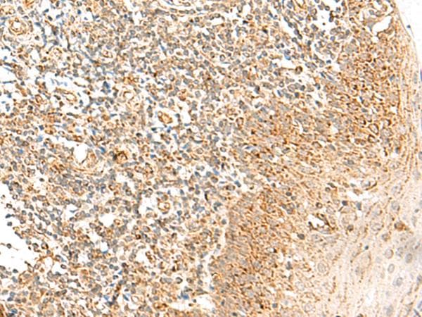 Polyclonal Rabbit anti-Human MRPS18B Antibody (IHC, WB)