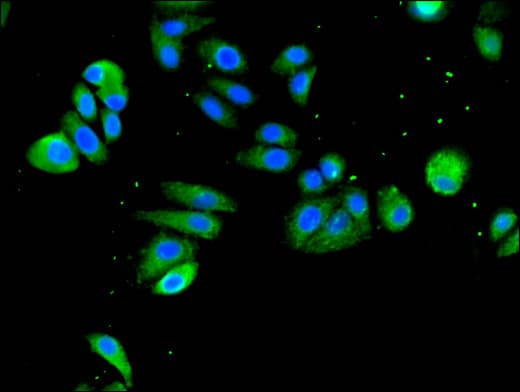 Polyclonal Rabbit anti-Human SLC18A2 / VMAT2 Antibody (IF, WB)