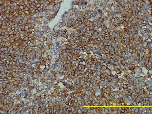 Monoclonal Mouse anti-Human CLTB Antibody (clone 4B12-1E3, IHC, IF, WB)
