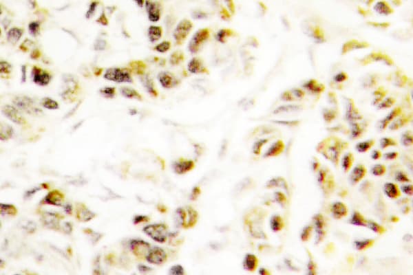 FEN1 Antibody (Ala119)