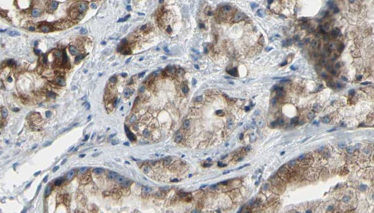 PAK4 Antibody
