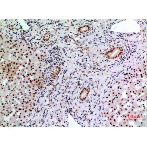 Polyclonal Rabbit anti-Human BCL6 Antibody (271-320 aa, Internal, IHC, WB)