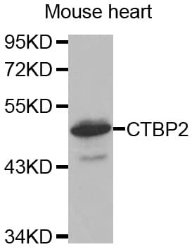 Polyclonal Rabbit anti-Human CTBP2 Antibody (WB)