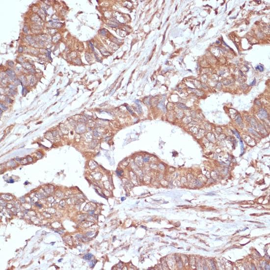 YAP / YAP1 Antibody