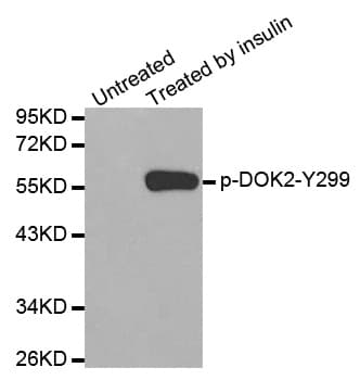 DOK2 Antibody (phospho-Tyr299)