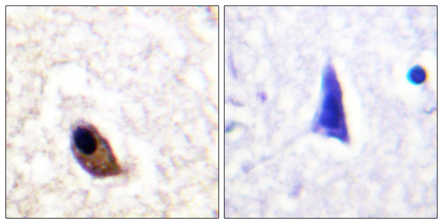 Polyclonal Rabbit anti-Human GRIN2A+GRIN2B Antibody (phospho-Tyr1246/1252, IHC, IF)