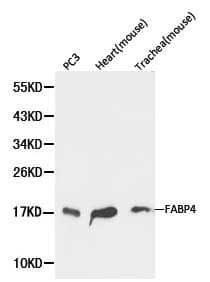 FABP4 / AP2 Antibody