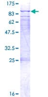 Human WBSCR17 Protein (Recombinant GST)