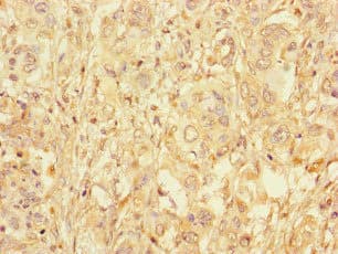 GAA / Alpha-Glucosidase, Acid Antibody (aa601-952)