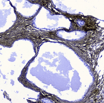 Lumican Antibody