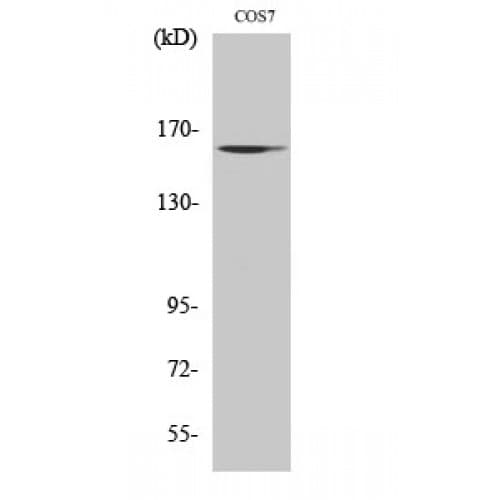 MSH6 Antibody (310-390 aa, Internal)