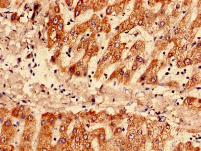 SAA1 / SAA / Serum Amyloid A Antibody