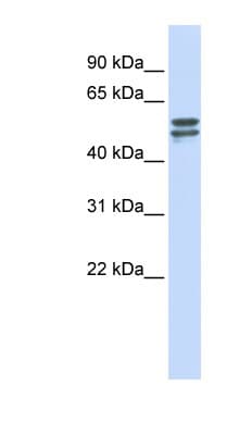 G6PD Antibody (aa180-229)