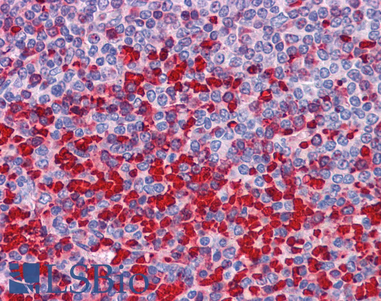 IHC-plus™ APBA2 Antibody