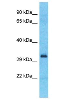 SPDYE2L Antibody (aa150-199)