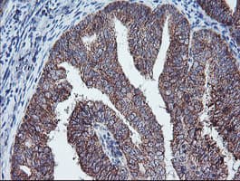 ECI2 / PECI Antibody (clone OTI1C8)