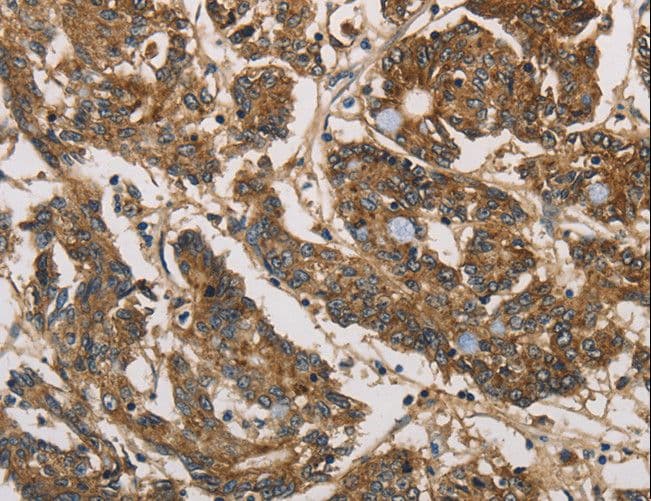 UBE2S / E2 EPF Antibody