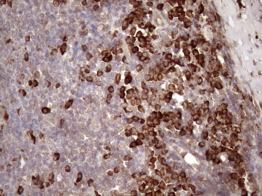 CSF2RB / CD131 Antibody (clone OTI4H3)
