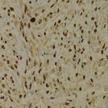 PPP1R8 / Rnase E Antibody