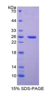 Mouse MAP1L / MAP1A Protein (Recombinant His-T7)