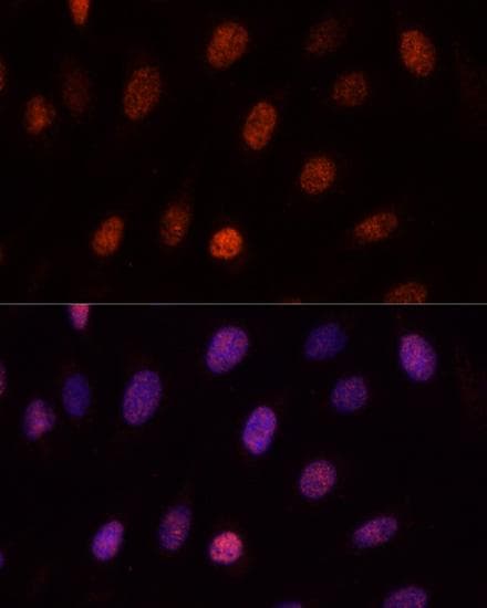 NSPC1 / PCGF1 Antibody