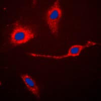 CASP3 / Caspase 3 Antibody (Internal)
