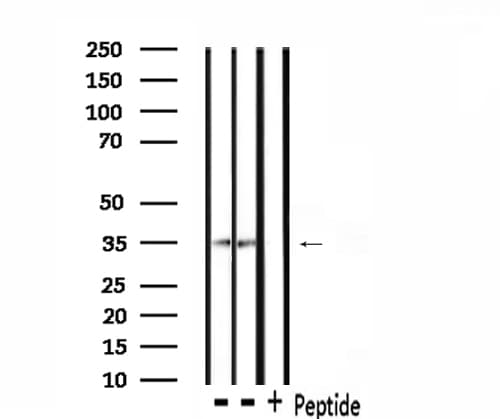 Polyclonal Rabbit anti-Human CSNK1A1 / CK1 Alpha Antibody (IHC, IF, WB)