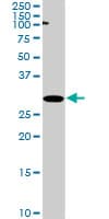 Monoclonal Mouse anti-Human RPRD1A Antibody (clone 1B8, WB)