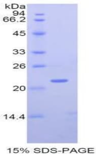 Human MMP12 Protein (Recombinant His)