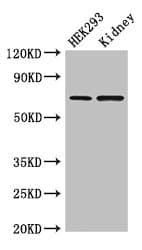 RABGGTA Antibody