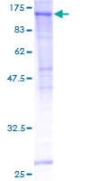 Human SEC24C Protein (Recombinant GST)
