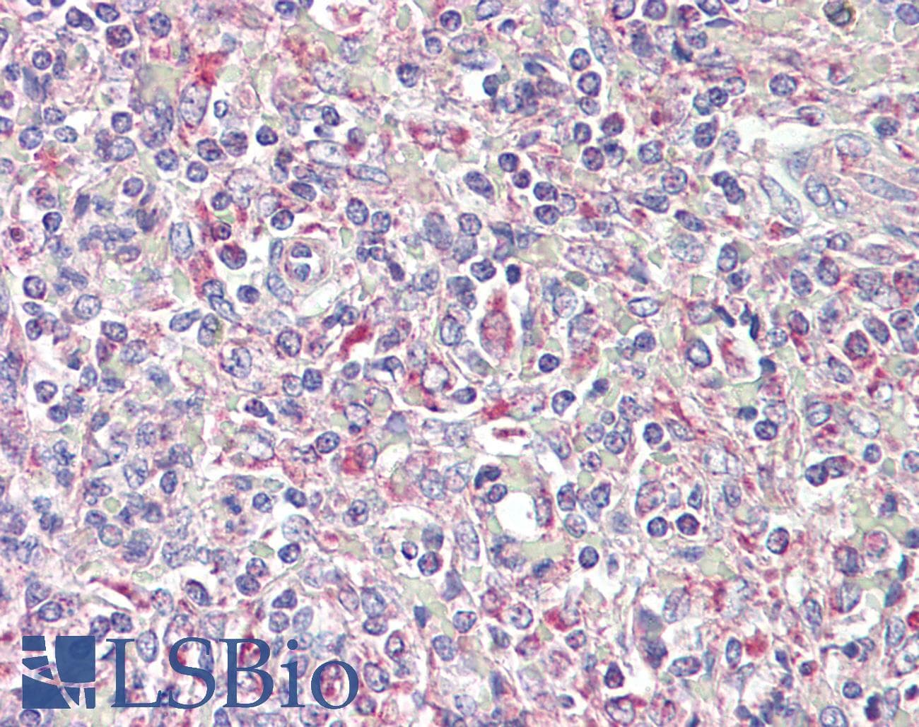 IHC-plus™ TRIB1 Antibody (aa353-366)