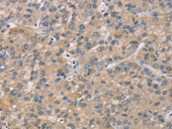 Polyclonal Rabbit anti-Human ZBTB3 Antibody (IHC)