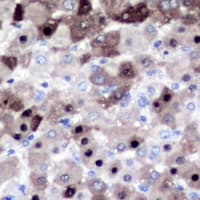 CSE1L Antibody (N-Terminus)