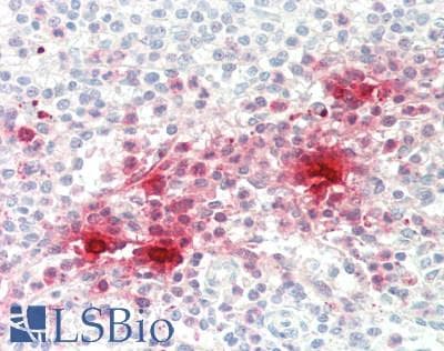 IHC-plus™ DEFA1 / Defensin Alpha 1 Antibody (Internal)