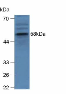 GBA / Glucosidase Beta Acid Antibody (aa255-509)