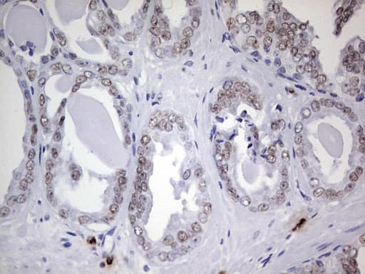 Monoclonal Mouse anti-Human NKX3-1 Antibody (clone OTI2D11, IHC, WB)