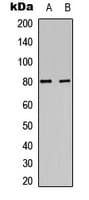 PRKCA / PKC-Alpha Antibody (C-Terminus)
