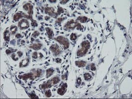 RTKN / Rhotekin Antibody (clone OTI1A4)