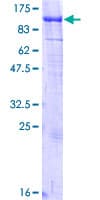 Human KIF2C / MCAK Protein (Recombinant GST)