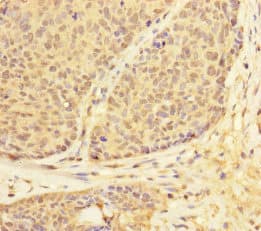 Polyclonal Rabbit anti-Human USP28 Antibody (IHC, WB)