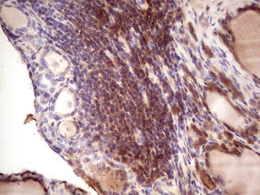 Monoclonal Mouse anti-Human IGF1 Antibody (clone OTI4B12, aa1-151, IHC, WB)