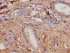 Polyclonal Rabbit anti-Human PIP / GCDFP-15 Antibody (WB)