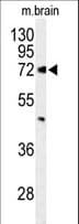 ABCD2 / ALDR Antibody (aa269-298)