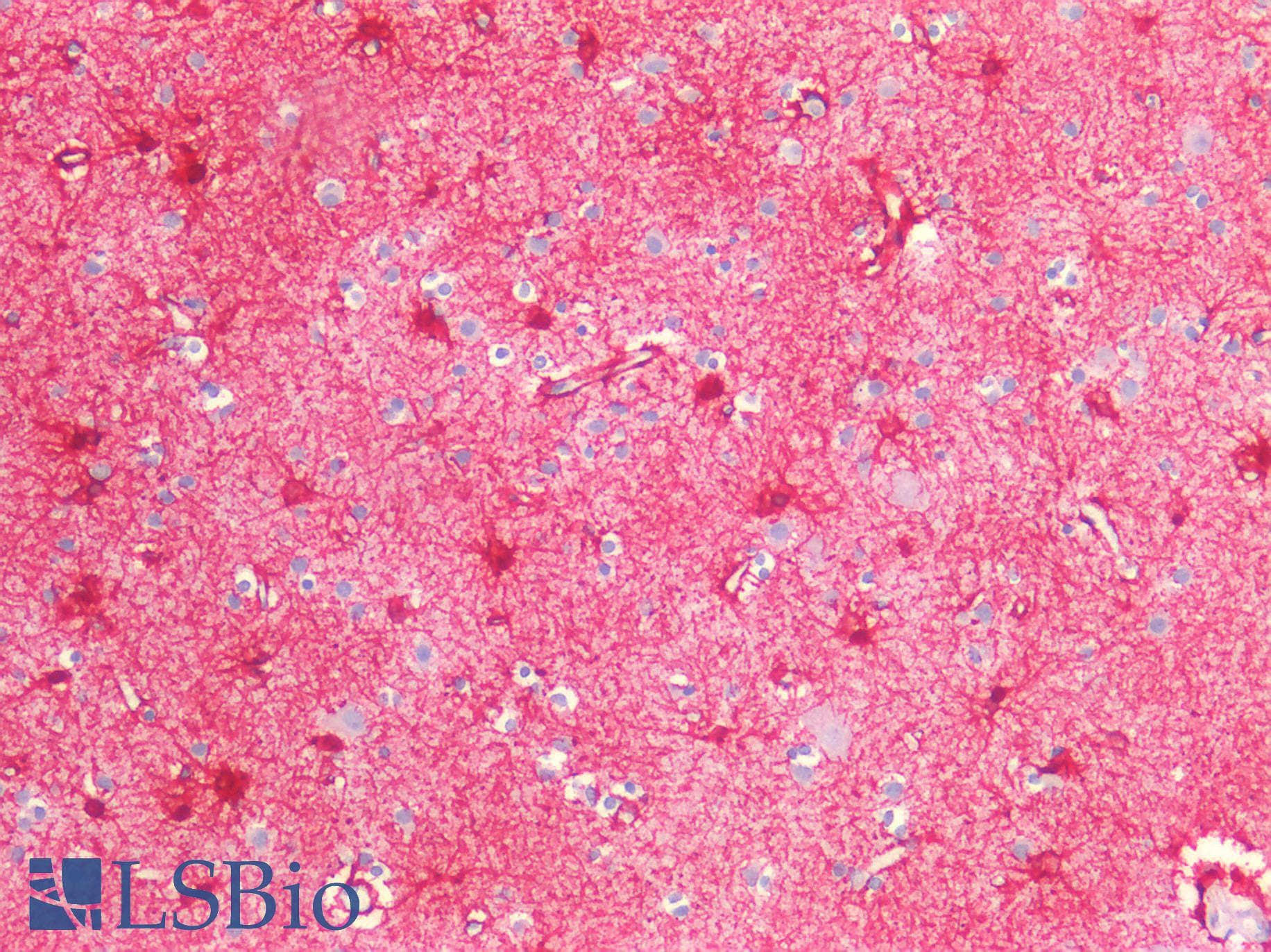 GFAP Antibody (aa1-430)