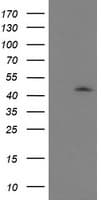 GDAP1L1 Antibody (clone OTI1G5)