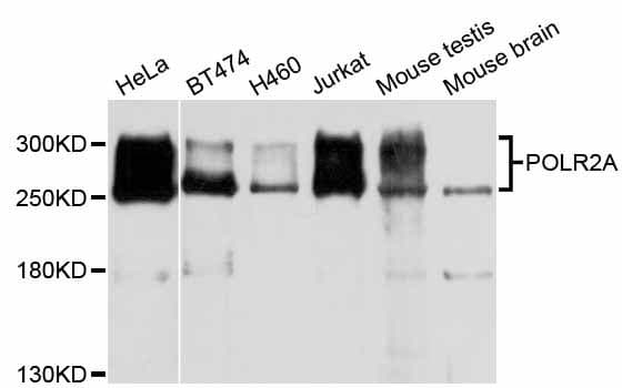 POLR2A / RNA polymerase II Antibody