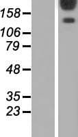 Gravin / AKAP12 Protein (Over-Expression Lysate Myc-DDK (Flag))