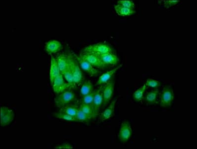 IHC-plus™ CSTB / Cystatin B / Stefin B Antibody