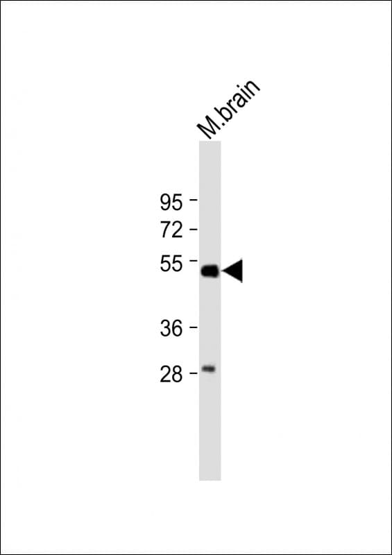 Tubulin beta-5 chain Antibody